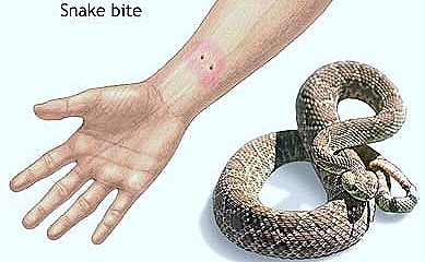 [snake-bite%255B14%255D.jpg]
