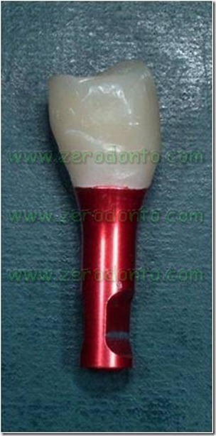 Dente composito