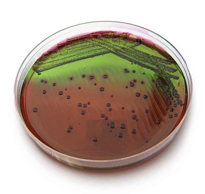 E. coli em ágar EMB. Crédito: Michigan State University