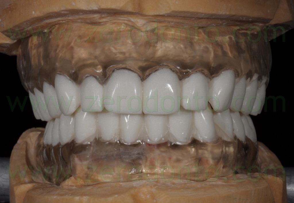 [--48-denti-in-bario2.jpg]
