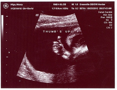 Thumbs Up
