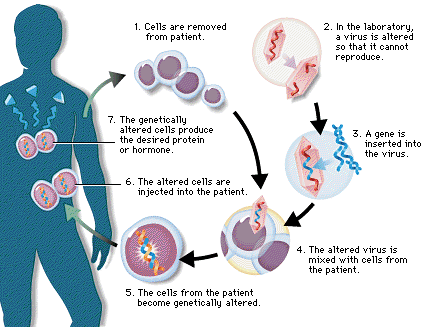 gene therapy