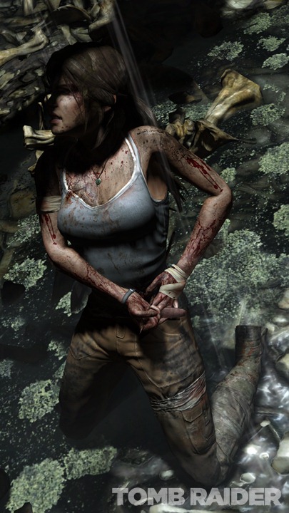 [Lara-Injured-Fullsize%255B10%255D.jpg]