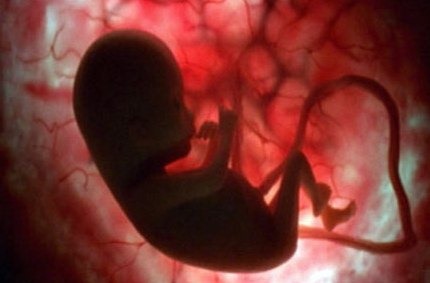 [bebe7%255B3%255D.jpg]