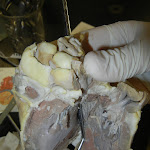 z_probe_aorta.JPG