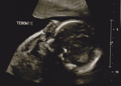2012-01-11 ultrasound 1
