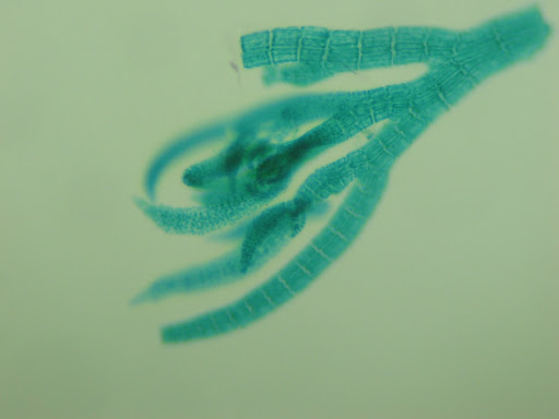 Polysiphonia Antheridia