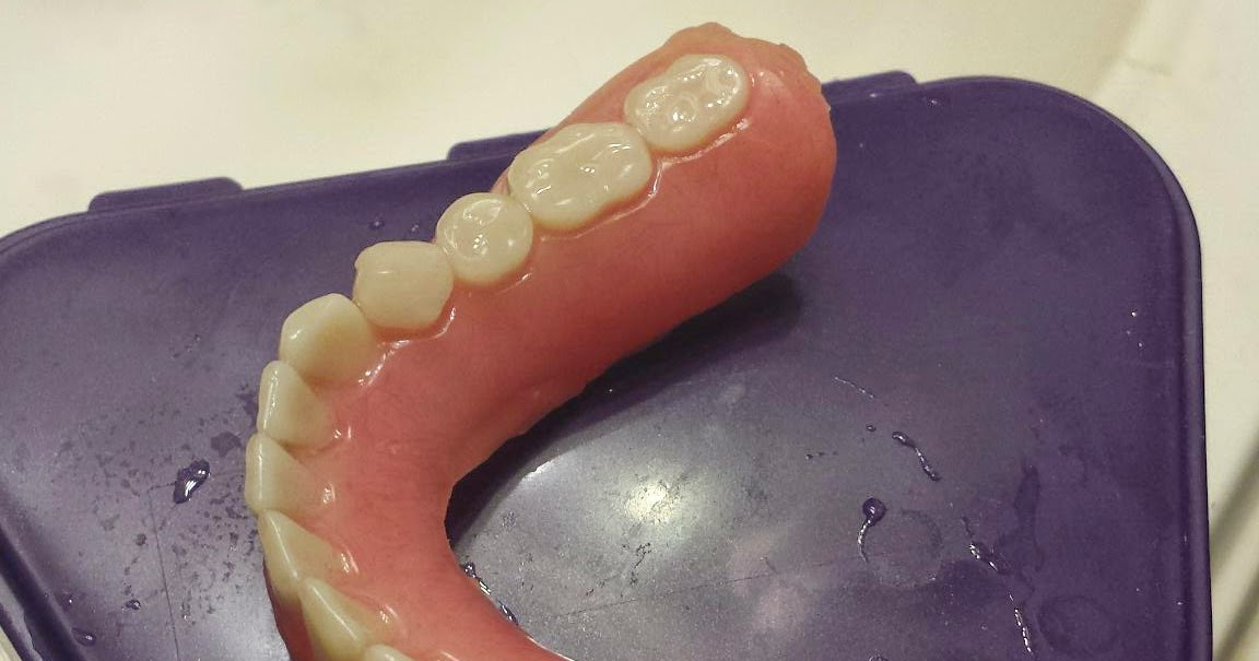 Cheyenne's Denture Journey This is not what a denture is supposed to