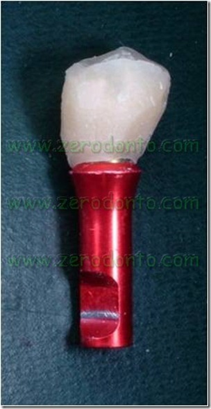 Dente resina