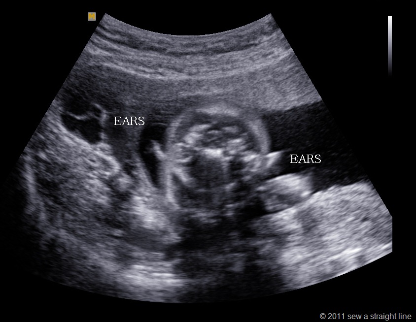[BABY%2520GUBLER_0001%255B7%255D.jpg]