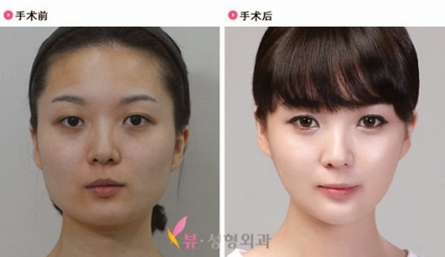[korean-plastic-surgery-45%255B2%255D.jpg]