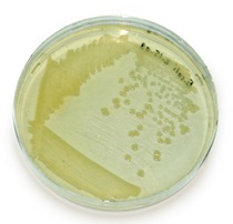 trypticsoy_e.coli