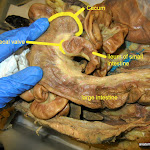 ileocecal_valve_L.JPG