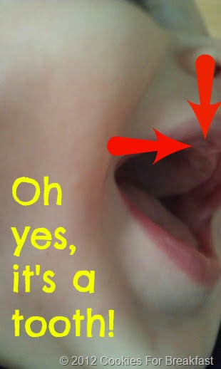 [Tooth%2520edit%255B8%255D.jpg]