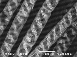 electron microscope images Spirogyra (pondscum)