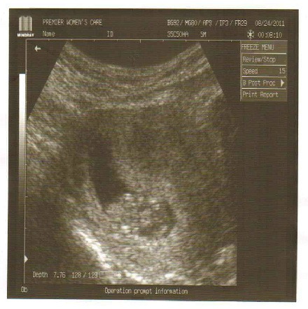 [TrishBaby4-2%255B4%255D.jpg]