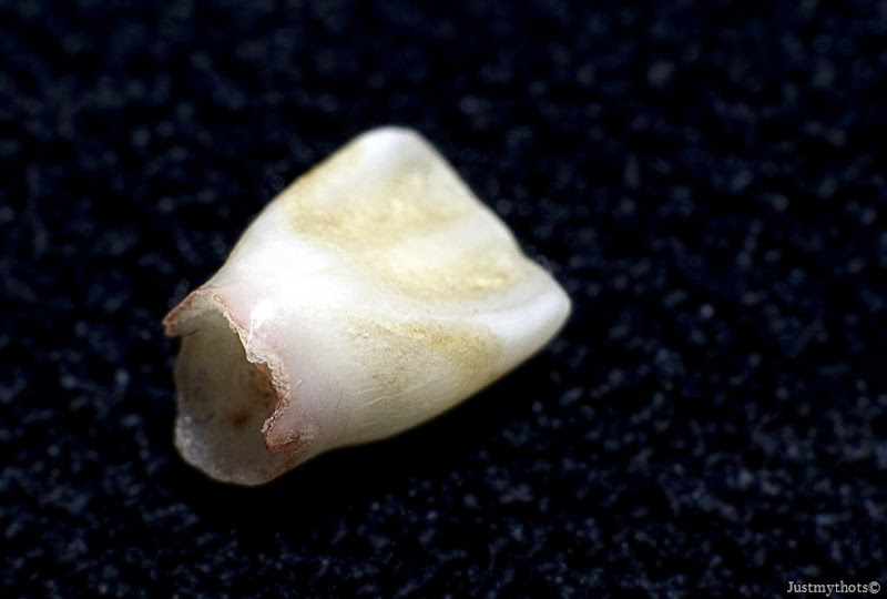 Tooth