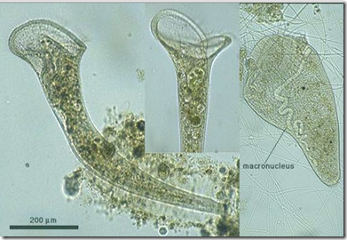 Klasifikasi protozoa