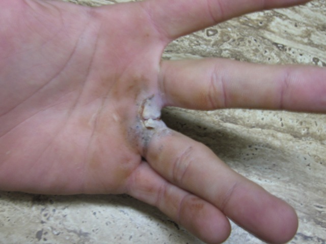 [hand2%255B1%255D.jpg]