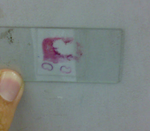 Lung Tissue Slide