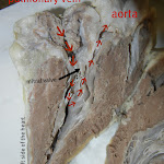heart_rightside_labeled.JPG