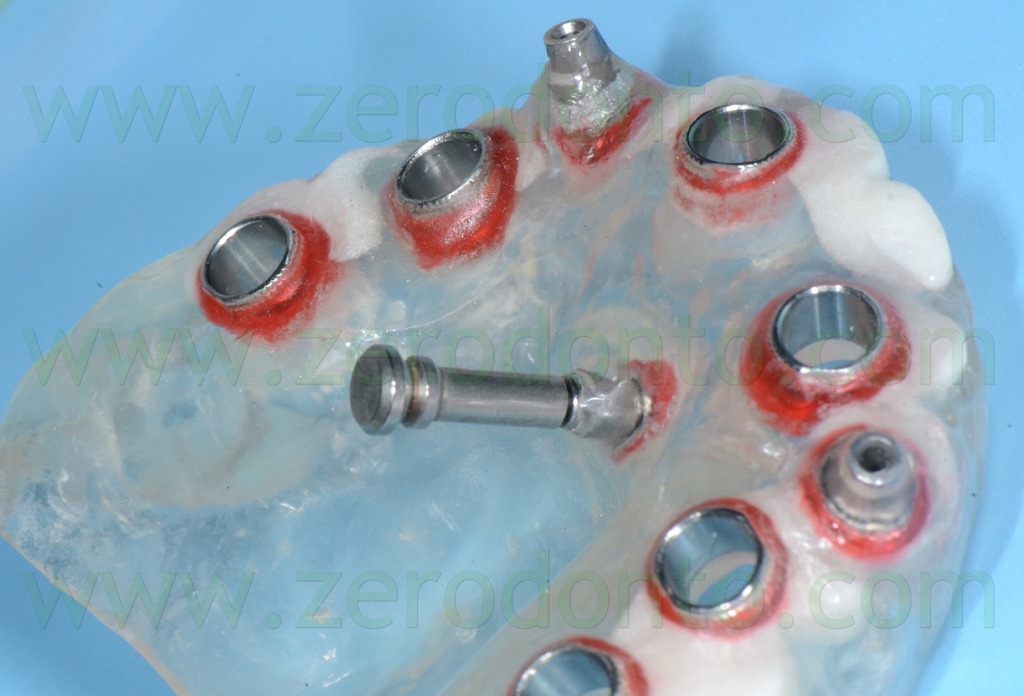 [--113-pin-di-stabilizzazione-nobel3.jpg]