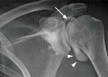 [mri%255B2%255D.jpg]