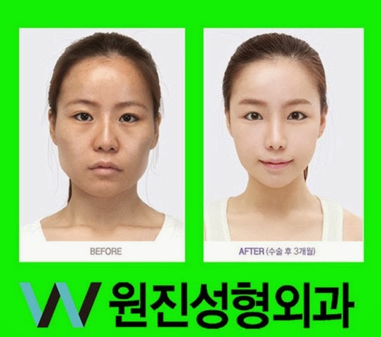 [korean-plastic-surgery-28%255B2%255D.jpg]