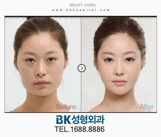 [korean-plastic-surgery-16%255B2%255D.jpg]