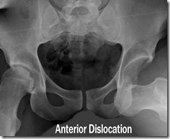 anterior2