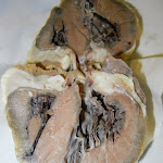 heart_chambers_closer.JPG