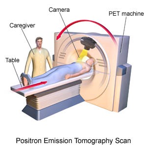 PET SCAN PET SCAN