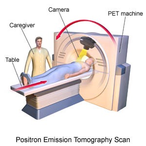 PET SCAN