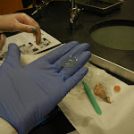 vitreous_fluid_02.JPG