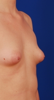 dh-pre-op-2.jpg