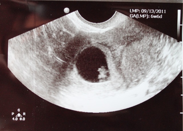 [BabyC%2520011%255B5%255D.jpg]