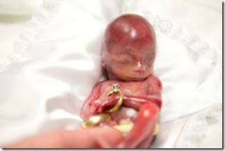 صورة طفل مولود في الأسبوع ال19 أي فى الشهر الرابع - 4