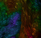 Patrizia Camelliti</p>
<p>Universidad de Oxford</p>
<p>Tiñendo las células del corazón con un pigmento especial que absorbe la luz del láser y utilizando una técnica denominada microscopio fluorescente de multifotón ha sido posible obtener esta imagen de las células en las capas más profundas del corazón. La estructura que forman, como si de un árbol se tratase, es esencial para generar la fuerza para bombear la sangre al resto del organismo.