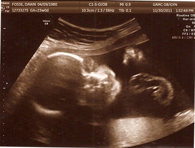 child #4 ultrasound 2
