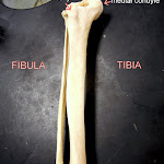 tibia_fibula_labeled.JPG