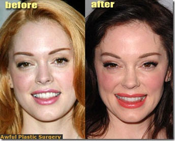 rose mcgowan plastic surgery