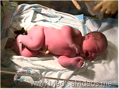 Caesarean section video with evidence-based surgical technique