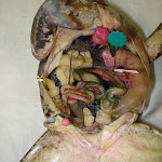 frog_duodenum.JPG