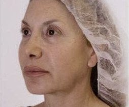 [square_women1before%255B2%255D.jpg]