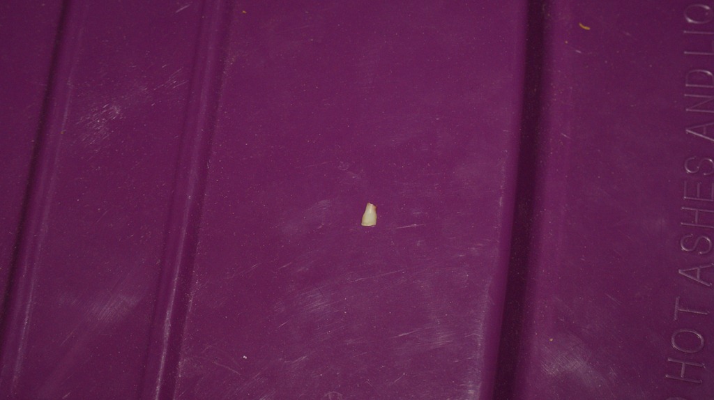 [my-first-tooth-out-0043.jpg]