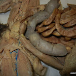 uterine_horns.JPG
