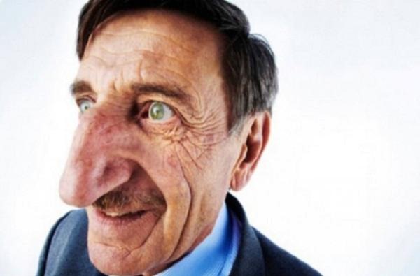 [biggest_nose_01%255B2%255D.jpg]