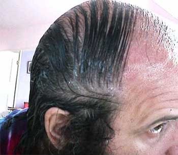[comb_overs_31%255B2%255D.jpg]