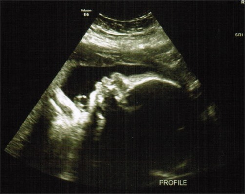 profile ultrasound 31 weeks