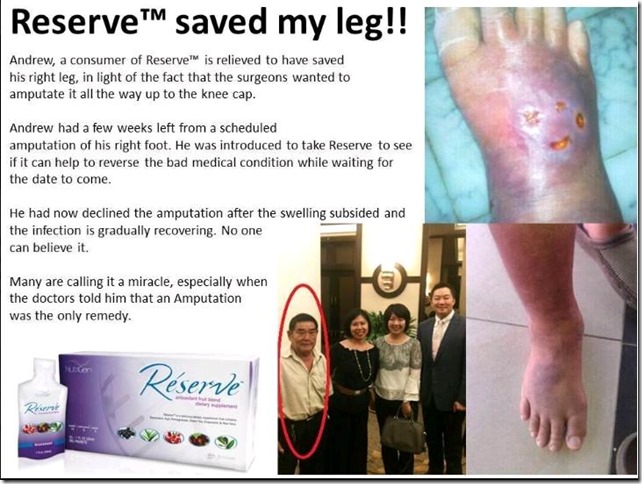 30_Diabetes patient leg was saved by Reserve